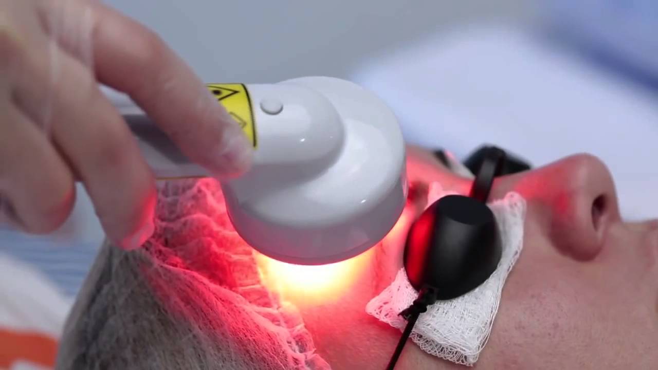 Laserterapia na micropigmentação